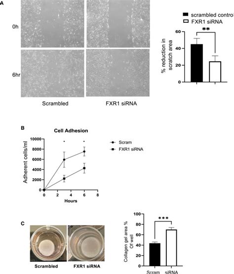 Fxr1 Regulates Vascular Smooth Muscle Cell Cytoskeleton Vsmc