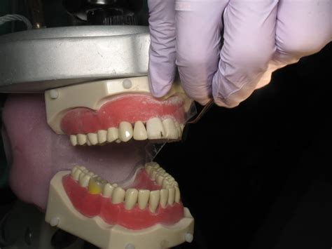 Practical Predictable And Beautiful Direct Anterior And Posterior Composite Restorations