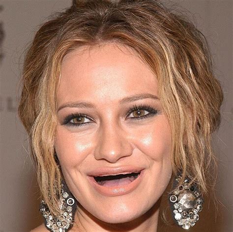 23 Lol Pictures Of Celebrities Without Teeth That Will Definitely Amuse You