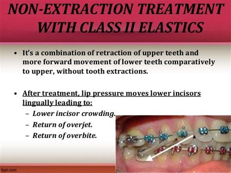 Treatment Of Class Ii Malocclusions