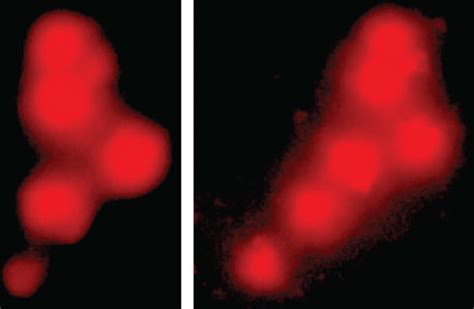 Comet Assay Showing Dna Damage In Isolated Cells Of The Liver Of Fish