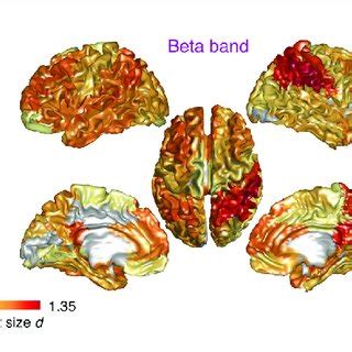 Cortical Distribution Of Spectral Differences Between Cognitively