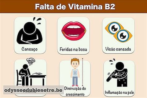 Síntomas De La Falta De Vitamina B2 Es Odysseedubienetre Be