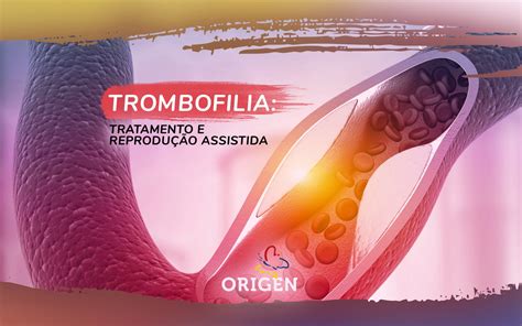 Trombofilia Tratamento E Reprodu O Assistida Cl Nica Origen