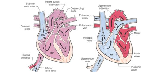 Peds Unit Cardiac Flashcards Quizlet