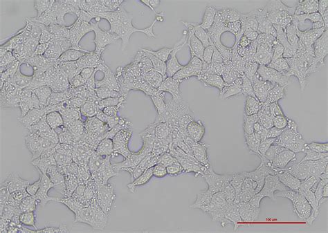 人乳腺导管癌细胞 Bt 474 （str鉴定正确）细胞系细胞库旗赛生物科技（武汉）有限公司