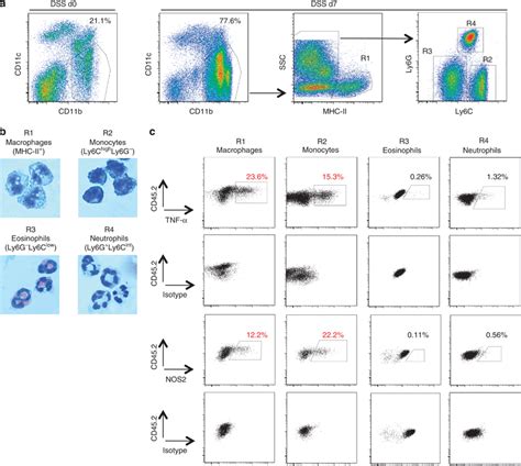 Role Of Monocytes And Macrophages In The Development Of Colitis A