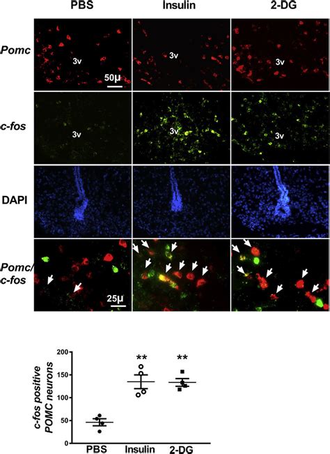 Activation Of Pomc Neurons In The Arcuate Nucleus By Hypoglycemia Or