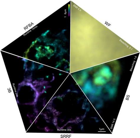 Efficient Super Resolution Volumetric Imaging By Radial Fluctuation