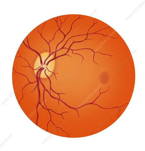 Normal Retina - Stock Image - C001/4983 - Science Photo Library