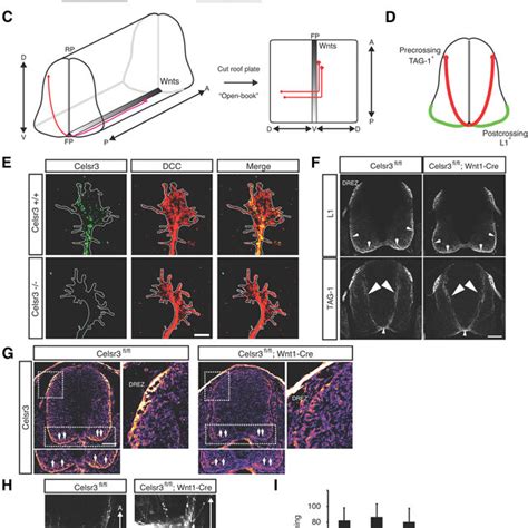 Frizzled Undergoes Endocytosis Via The Filopodia Tips Of Commissural