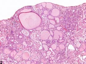 Kidney Nephropathy Chronic Progressive Nonneoplastic Lesion Atlas