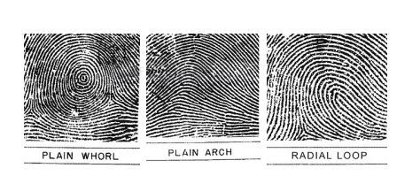 Pola Pembentukan Sidik Jari Dermatoglifi Loop Arch Dan Whorl