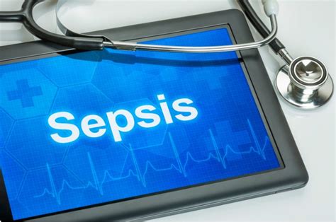 What Is Sepsis Symptoms Causes Treatment And Facts