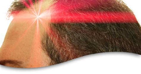 What Is Laser Hair Therapy? - Core Life Blog - Prepare Your Will ...