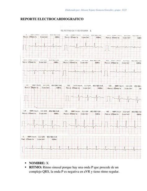 Reporte Electrocardiograma Alisson Gomora Gonzalez UDocz