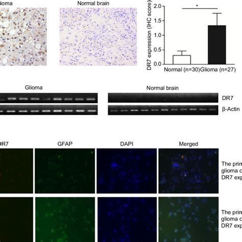 Dr7 Can Be Detected In The Glioma Tissues And Primary Cultured Human