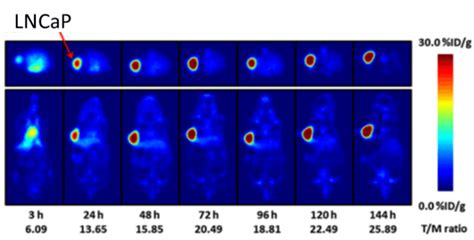 PET Images Highlight The Pharmacologic Properties Of 89 Zr 5B1 In Human