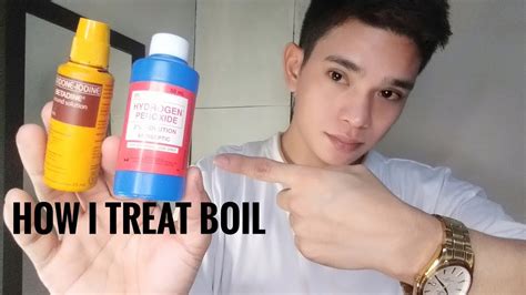 How To Treat Boil Home Remedy Gamot Sa Pigsa Rhenhart Losaria