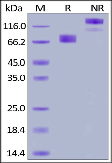 Growth Hormone Receptor Fc Chimera Active Abcam