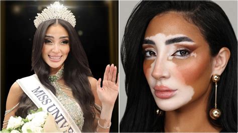 Logina Salah Miss Egipto Es La Primera Mujer Con Vit Ligo Que