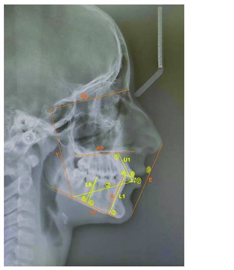 The Angular And Linear Skeletal Measurements Download Scientific Diagram