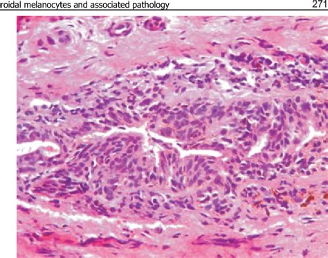 Melanocytes Histology