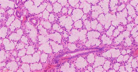 Human Parotid gland cross-section histology slides, 7 µm sec., H&E ...