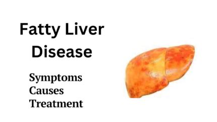 Fatty Liver Disease Hepatic Steatosis Risk Factor Symptom