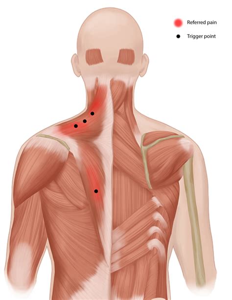 Myofascial Physiotherapy Perth Dr7 Physiotherapy Podiatry