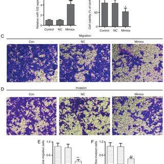 MiR 122 Suppresses Cell Proliferation Migration And Invasion In NPC