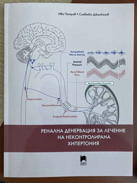 PDF Renal Denervation For Treatment Of Uncontrolled Hypertension