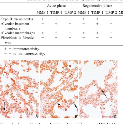 Figure From Localization And Potential Role Of Matrix