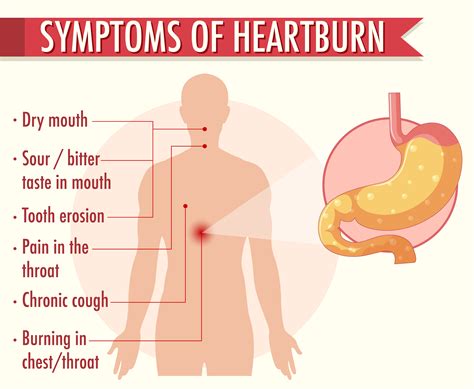 Symptoms of heartburn information infographic 1591684 Vector Art at