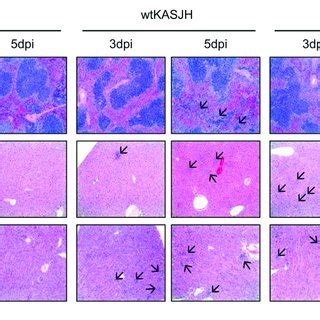 Histopathological Analysis Of Mice Infected With Parental And Rescued