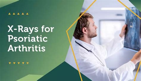 X Rays For Psoriatic Arthritis Mypsoriasisteam