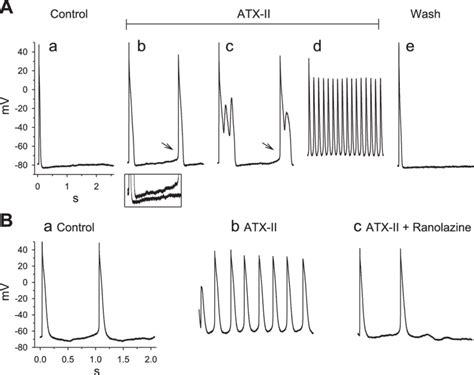 Anemone Toxin Ii Atx Ii Nmol L Accelerated Diastolic