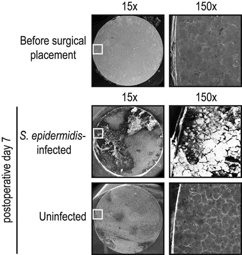 Biofilm Formation On The Implants On Postoperative Day 7 The