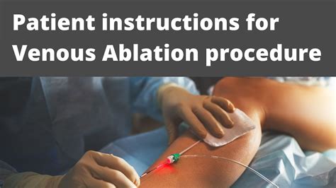 Patient Instruction For Venous Ablation Youtube