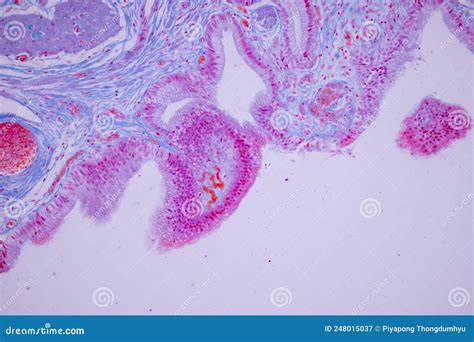 Columnar Epithelium Of Human Gall Bladder Under The Microscope In Lab