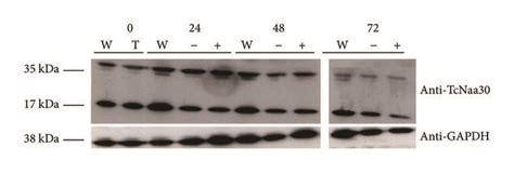 Phenotype Of The Knock Down Of Putative T Brucei Naa By Rnai