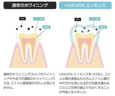 セルフホワイトニング（サロン）ってどう？メリットやデメリットと料金や効果を比較してみた タカのホワイトニング日記