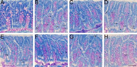 Toluidine Blue Staining For Mast Cells A Control Group B VH Group C