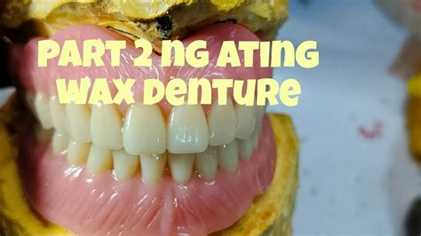 Part 2 Ng Ating Wax Trial Denture🥰🥰 Youtube