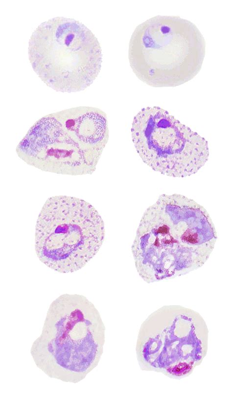 Demo 7 Differentiation Plasmodium Hematomorphology A Databank