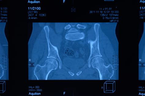 Urban Spine And Joint