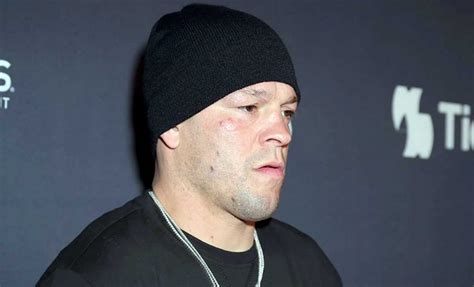 Orden De Arresto Emitida Para Nate Diaz WMMAA