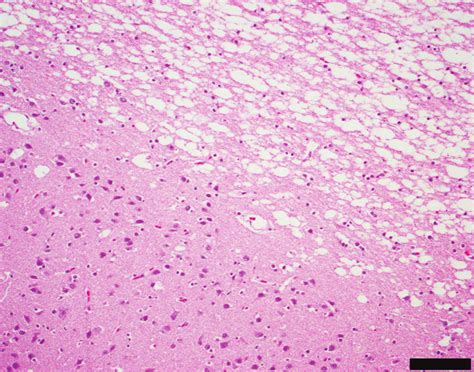 Photomicrograph Of The Gray And White Matter Junction Of A Cerebral Download Scientific Diagram