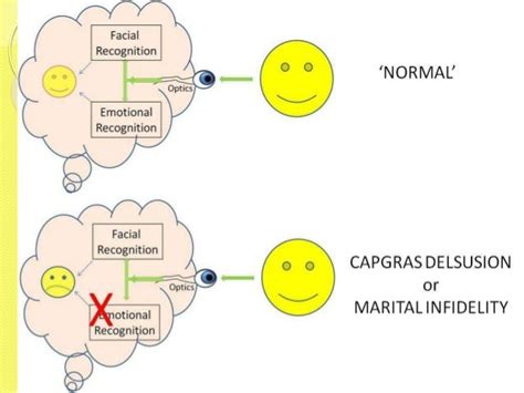 Capgras Syndrome