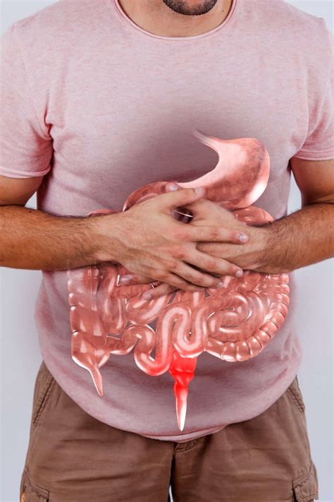 Understanding Small Intestinal Bacterial Overgrowth SIBO Insights